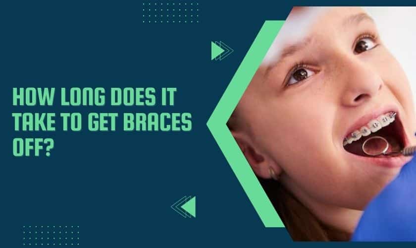 How Long Does It Take To Get Braces Off?
