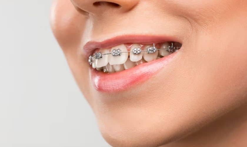 orthodontist mineola ny