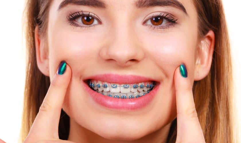 Braces and Oral Health: Maintaining Good Hygiene During Treatment