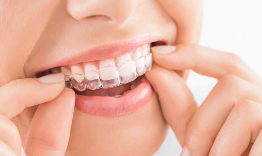 Invisalign vs. Traditional Braces: Pros and Cons of Each Treatment Option