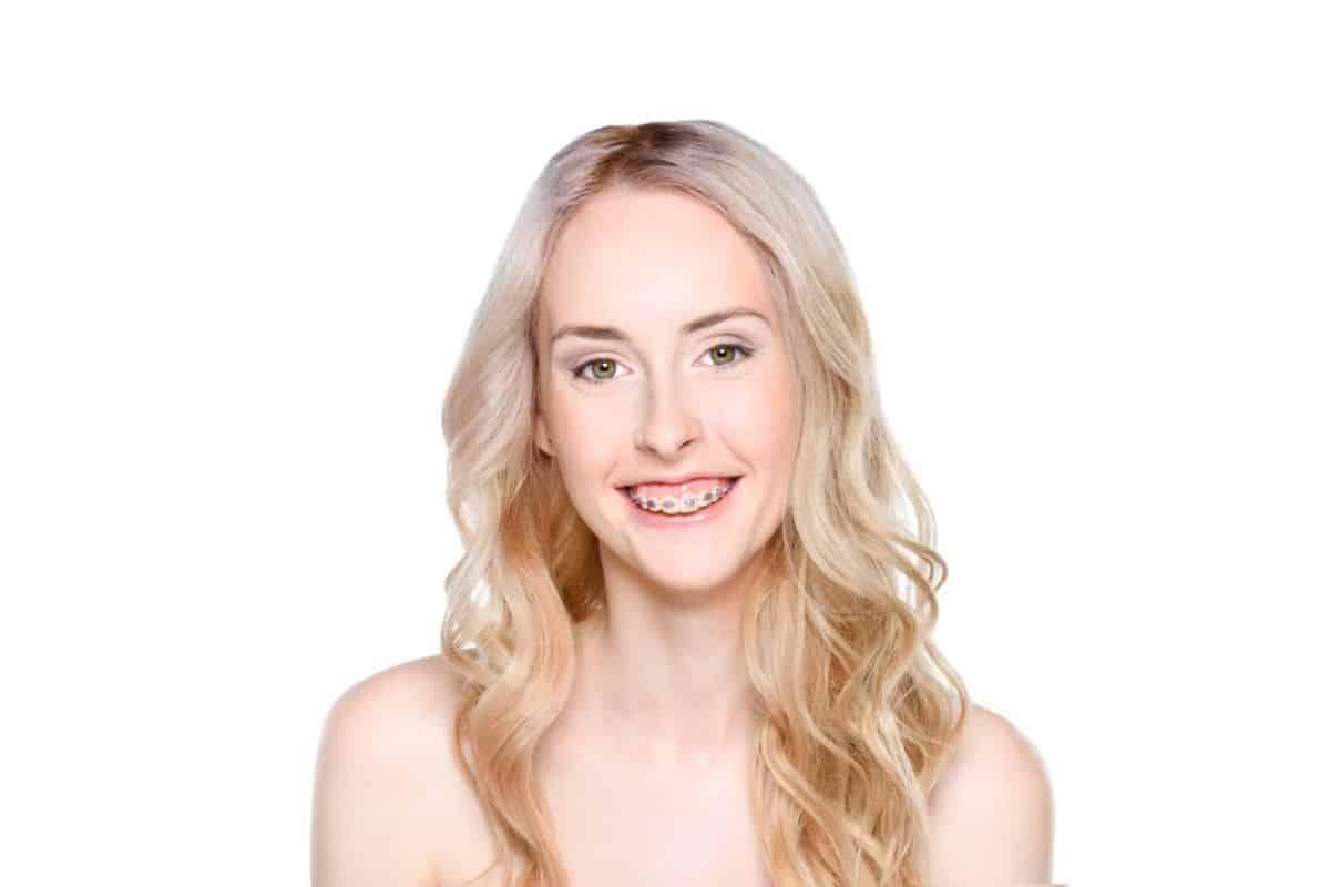 Adult with clear braces smiling confidently.